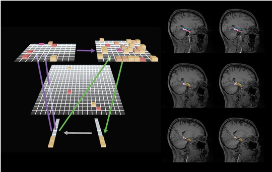 Memory errors in behavior, brains, and machines